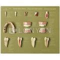 SOMSO牙齒保健模型